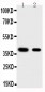 Anti-KLF5 Antibody